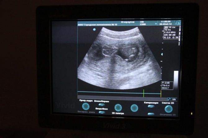 Активная беременность. (Путешествия, дети, путешествия, горы)