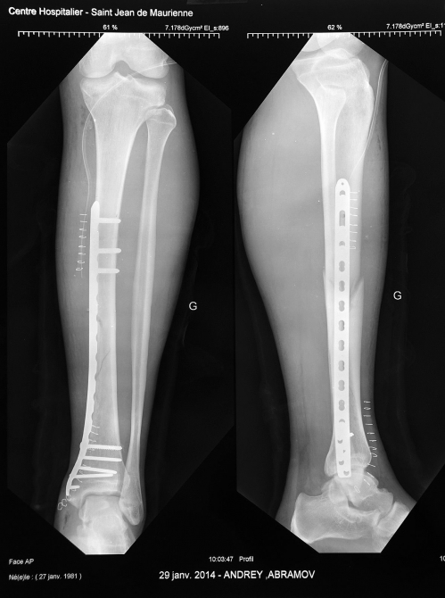 Про самую большую в долине Морьен зону катания и немного про пользу страховки :, Бэккантри/Фрирайд, альпы, ски-тур, les sibbeles, спидфлайнг, bd)